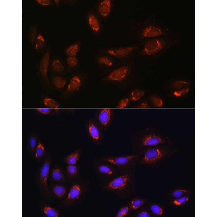 Immunofluorescence - Anti-RALGDS Antibody (A93309) - Antibodies.com