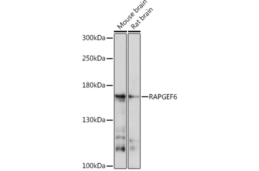 Western Blot - Anti-RAPGEF6 Antibody (A93310) - Antibodies.com