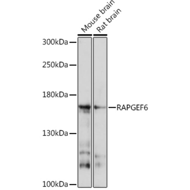 Western Blot - Anti-RAPGEF6 Antibody (A93310) - Antibodies.com