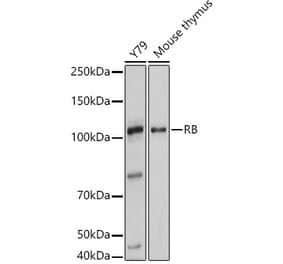 Western Blot - Anti-Rb Antibody (A93312) - Antibodies.com