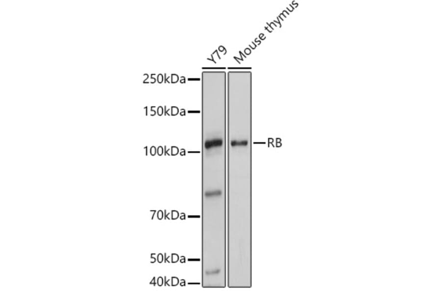 Western Blot - Anti-Rb Antibody (A93312) - Antibodies.com