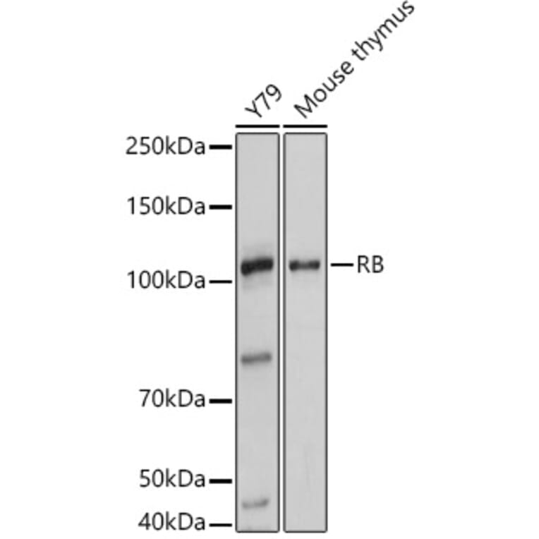 Western Blot - Anti-Rb Antibody (A93312) - Antibodies.com