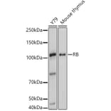 Western Blot - Anti-Rb Antibody (A93312) - Antibodies.com