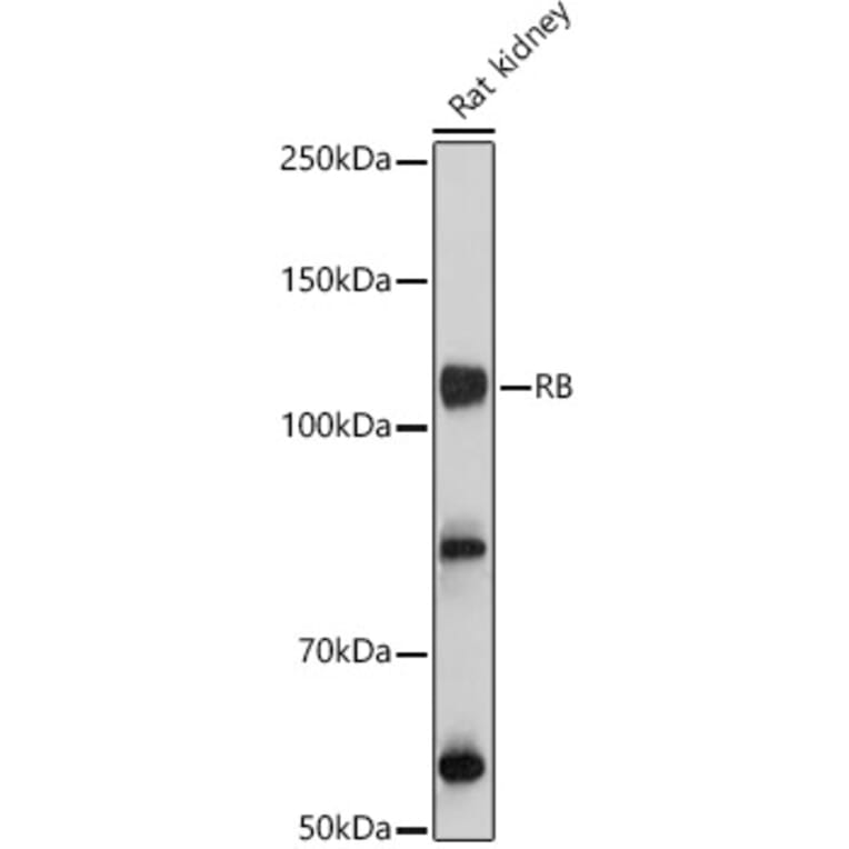 Western Blot - Anti-Rb Antibody (A93312) - Antibodies.com