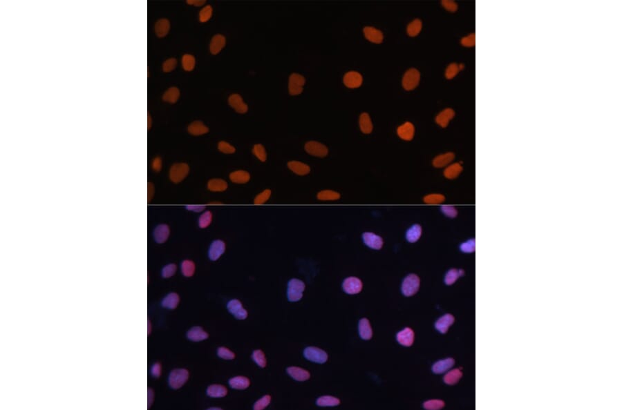 Immunofluorescence - Anti-Rb Antibody (A93312) - Antibodies.com