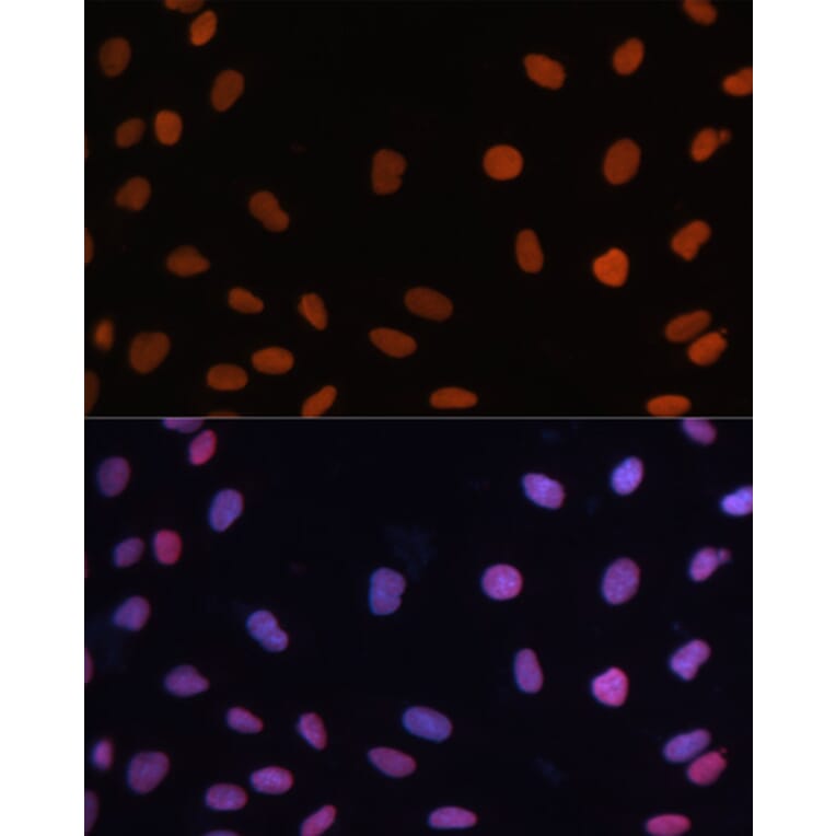 Immunofluorescence - Anti-Rb Antibody (A93312) - Antibodies.com