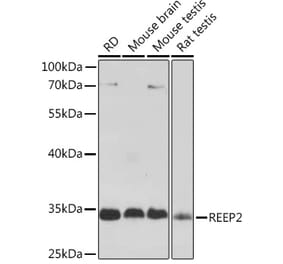 Western Blot - Anti-REEP2 Antibody (A93314) - Antibodies.com