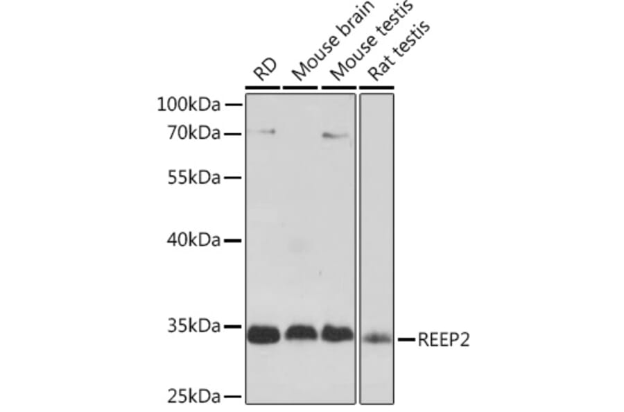 Western Blot - Anti-REEP2 Antibody (A93314) - Antibodies.com