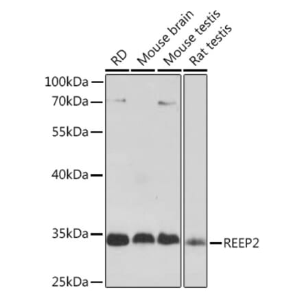 Western Blot - Anti-REEP2 Antibody (A93314) - Antibodies.com