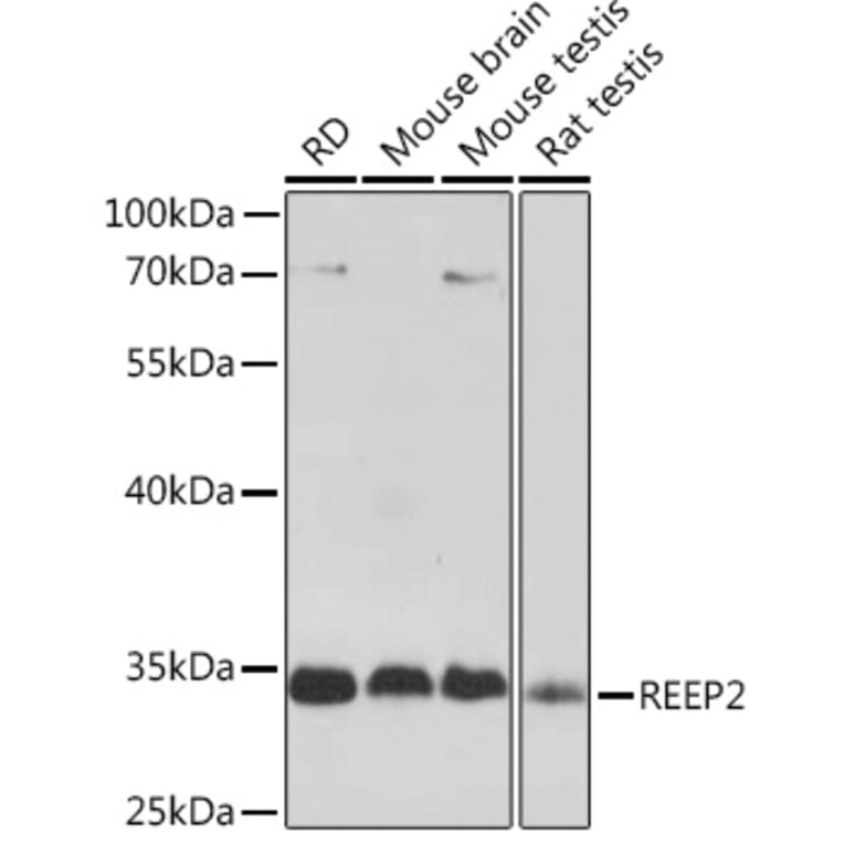 Western Blot - Anti-REEP2 Antibody (A93314) - Antibodies.com