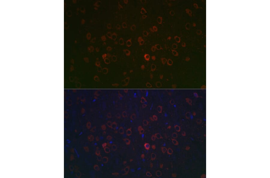 Immunofluorescence - Anti-REEP2 Antibody (A93314) - Antibodies.com