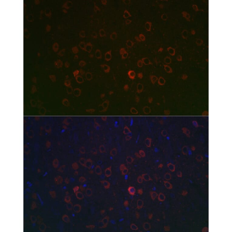 Immunofluorescence - Anti-REEP2 Antibody (A93314) - Antibodies.com