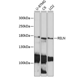Western Blot - Anti-Reelin Antibody (A93315) - Antibodies.com
