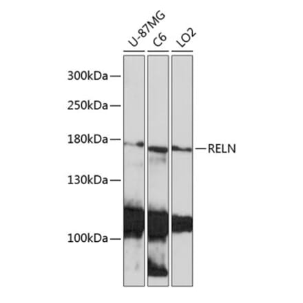 Western Blot - Anti-Reelin Antibody (A93315) - Antibodies.com