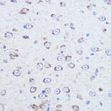 Immunohistochemistry - Anti-Reelin Antibody (A93315) - Antibodies.com