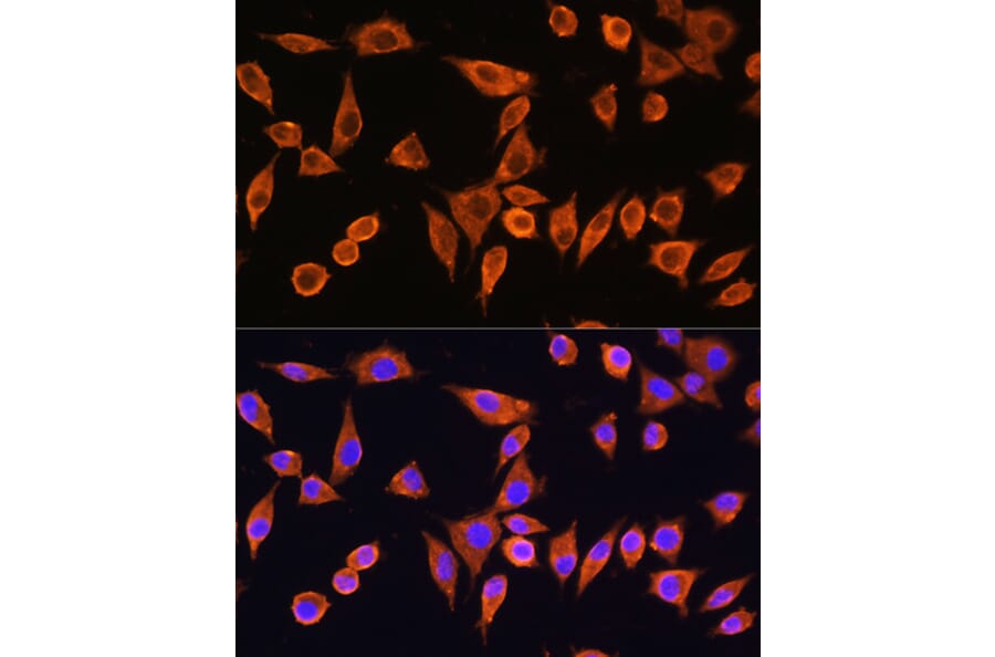 Immunofluorescence - Anti-RPS28 Antibody (A93318) - Antibodies.com