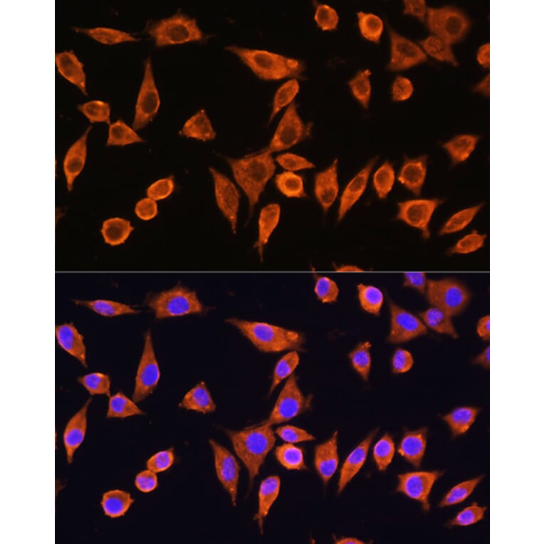 Immunofluorescence - Anti-RPS28 Antibody (A93318) - Antibodies.com
