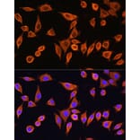 Immunofluorescence - Anti-RPS28 Antibody (A93318) - Antibodies.com