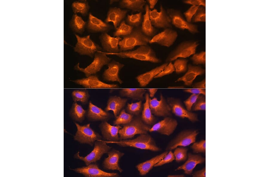 Immunofluorescence - Anti-RPS28 Antibody (A93318) - Antibodies.com