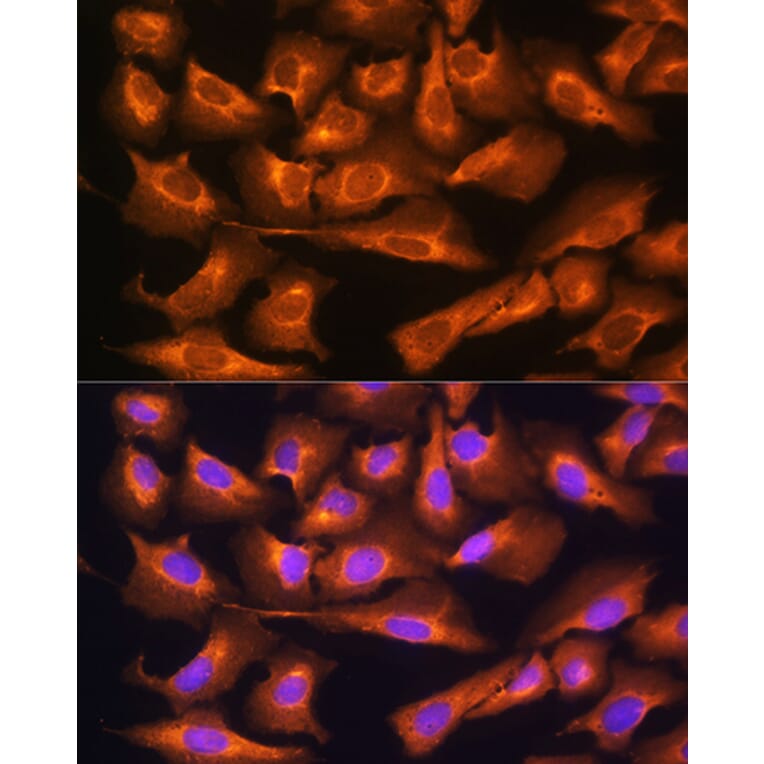 Immunofluorescence - Anti-RPS28 Antibody (A93318) - Antibodies.com