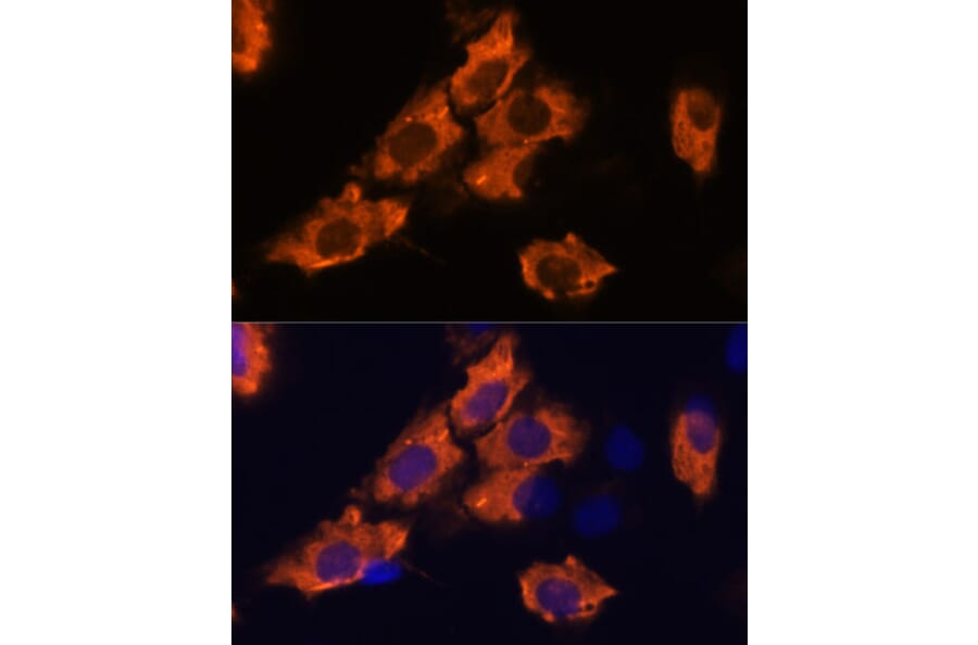 Immunofluorescence - Anti-SEMA4A Antibody (A93320) - Antibodies.com
