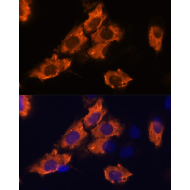 Immunofluorescence - Anti-SEMA4A Antibody (A93320) - Antibodies.com