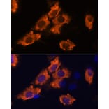 Immunofluorescence - Anti-SEMA4A Antibody (A93320) - Antibodies.com