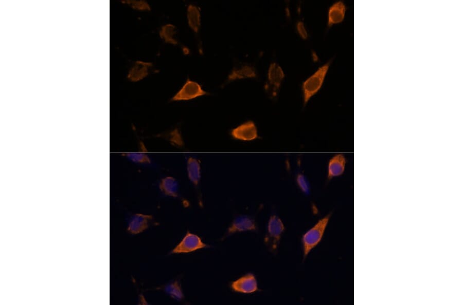 Immunofluorescence - Anti-SEMA4A Antibody (A93320) - Antibodies.com