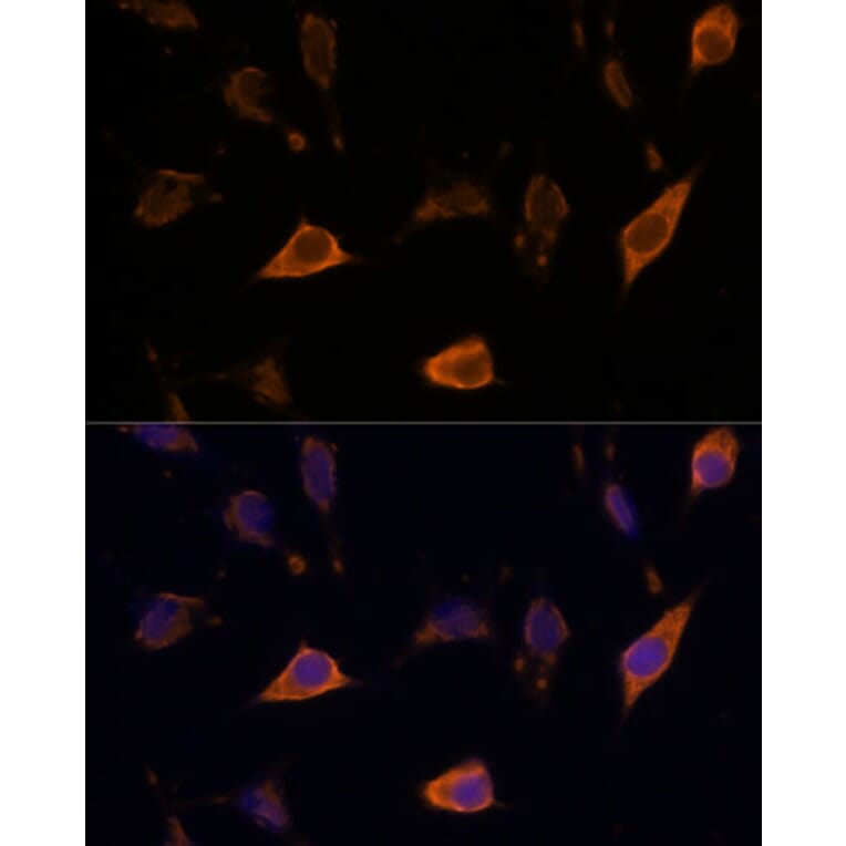 Immunofluorescence - Anti-SEMA4A Antibody (A93320) - Antibodies.com