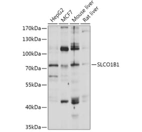 Western Blot - Anti-OATP1B1 Antibody (A93322) - Antibodies.com