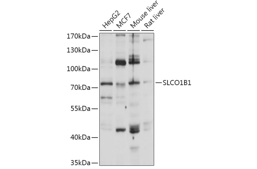 Western Blot - Anti-OATP1B1 Antibody (A93322) - Antibodies.com