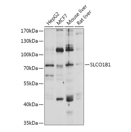 Western Blot - Anti-OATP1B1 Antibody (A93322) - Antibodies.com