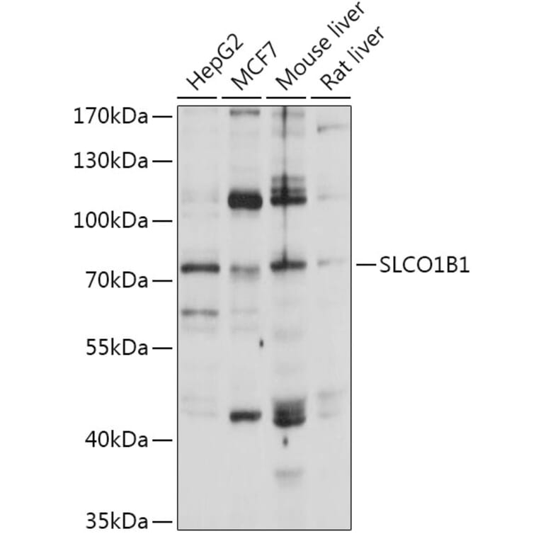 Western Blot - Anti-OATP1B1 Antibody (A93322) - Antibodies.com