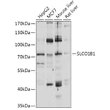 Western Blot - Anti-OATP1B1 Antibody (A93322) - Antibodies.com