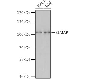 Western Blot - Anti-SLMAP Antibody (A93323) - Antibodies.com