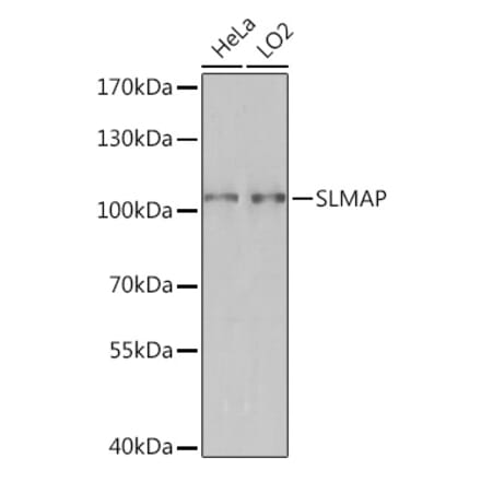 Western Blot - Anti-SLMAP Antibody (A93323) - Antibodies.com