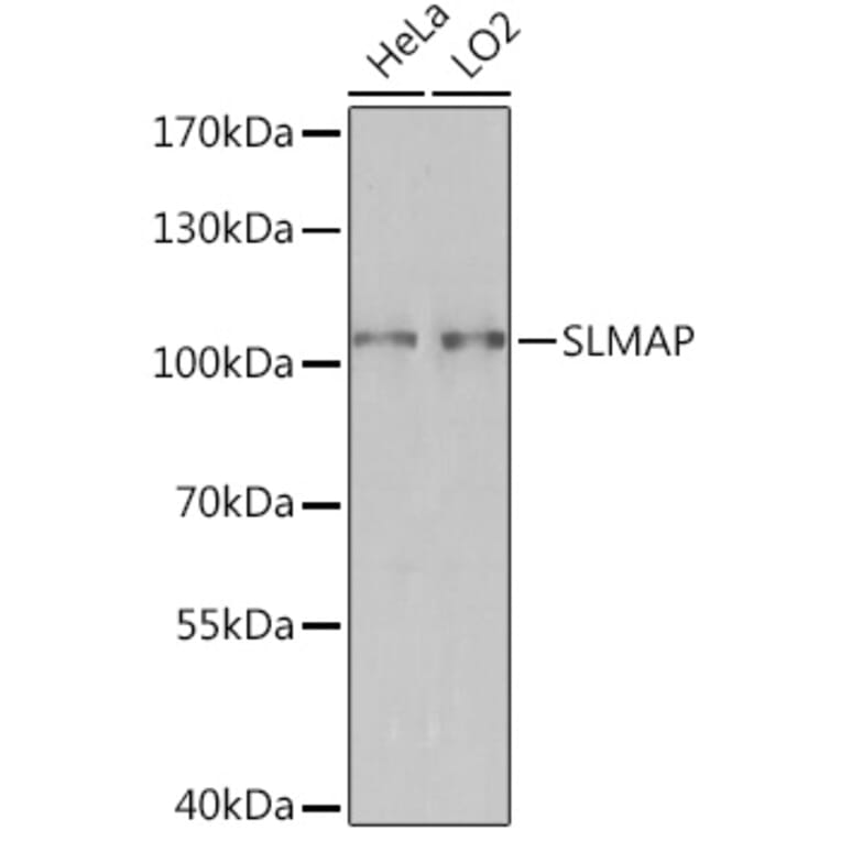 Western Blot - Anti-SLMAP Antibody (A93323) - Antibodies.com