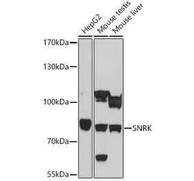 Western Blot - Anti-SNRK Antibody (A93325) - Antibodies.com