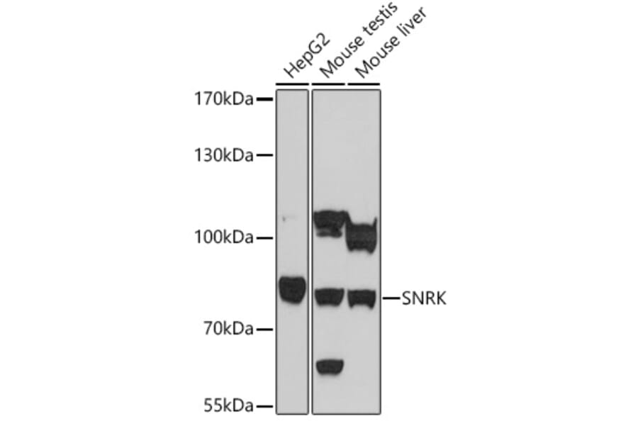 Western Blot - Anti-SNRK Antibody (A93325) - Antibodies.com