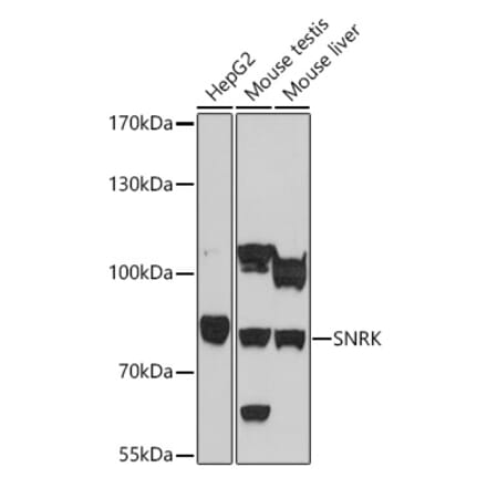 Western Blot - Anti-SNRK Antibody (A93325) - Antibodies.com