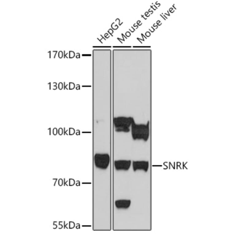 Western Blot - Anti-SNRK Antibody (A93325) - Antibodies.com