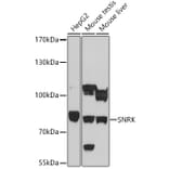 Western Blot - Anti-SNRK Antibody (A93325) - Antibodies.com