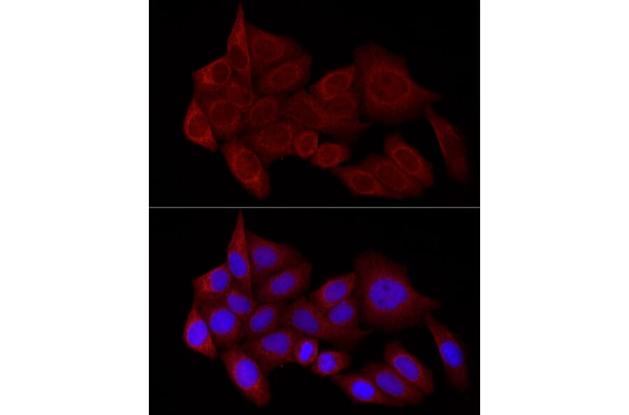 Immunofluorescence - Anti-STX17 Antibody (A93329) - Antibodies.com