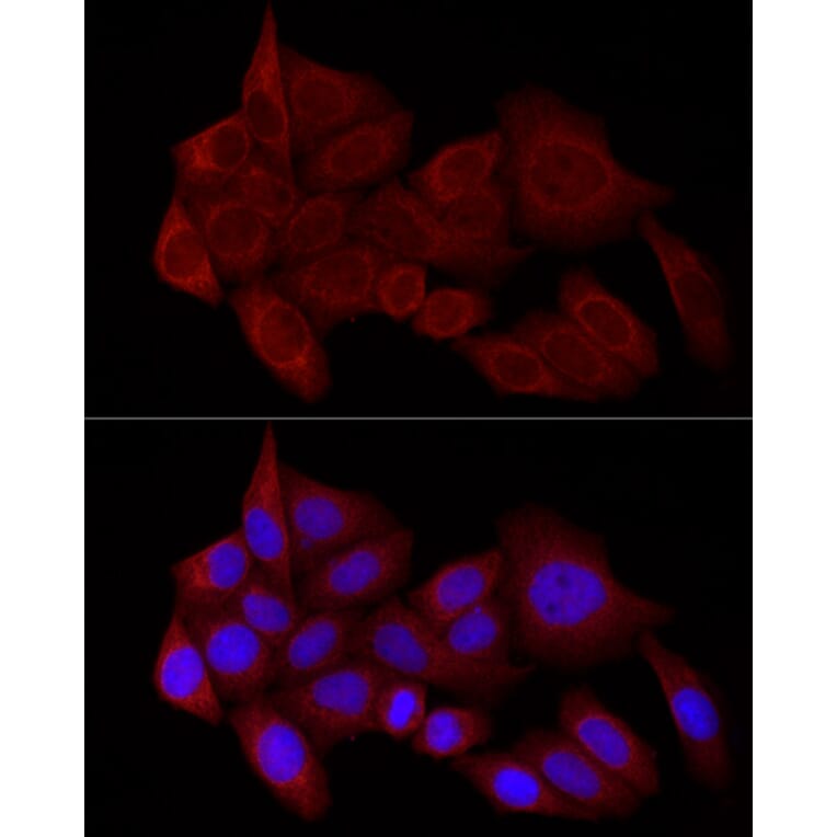 Immunofluorescence - Anti-STX17 Antibody (A93329) - Antibodies.com