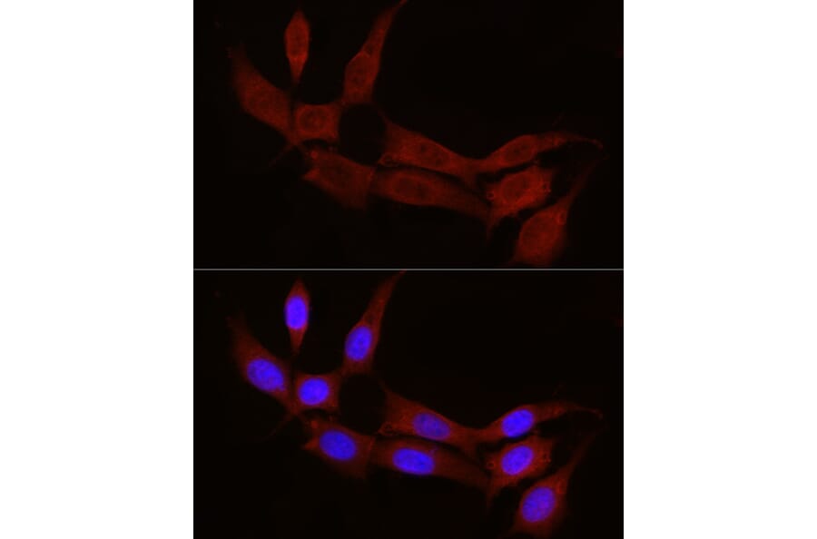 Immunofluorescence - Anti-STX17 Antibody (A93329) - Antibodies.com
