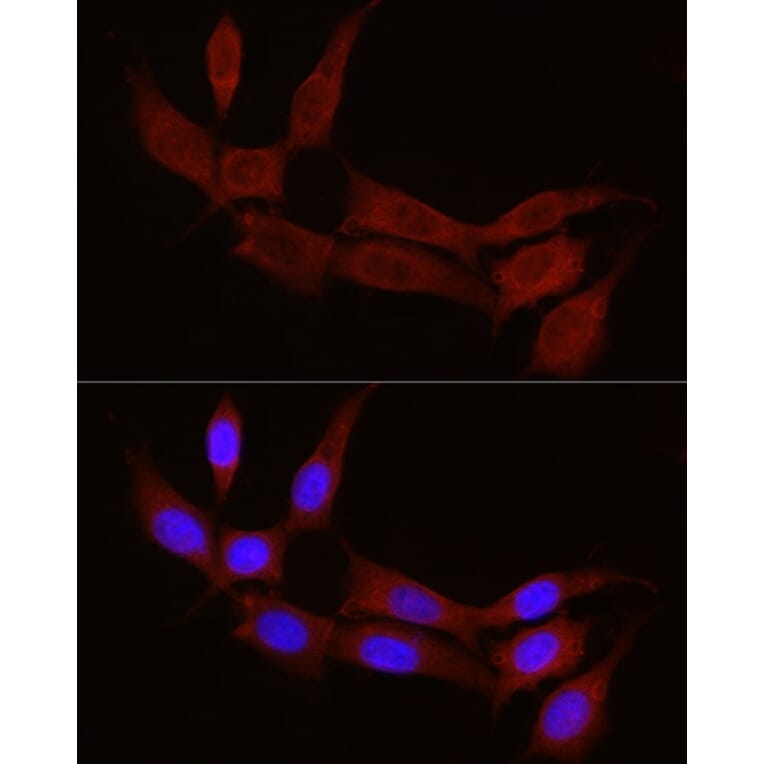 Immunofluorescence - Anti-STX17 Antibody (A93329) - Antibodies.com