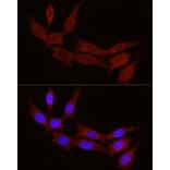 Immunofluorescence - Anti-STX17 Antibody (A93329) - Antibodies.com