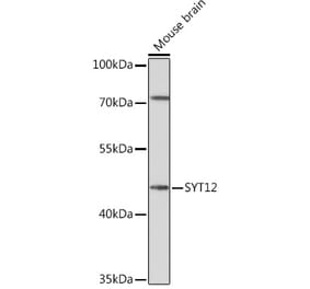 Western Blot - Anti-SYT12 Antibody (A93332) - Antibodies.com