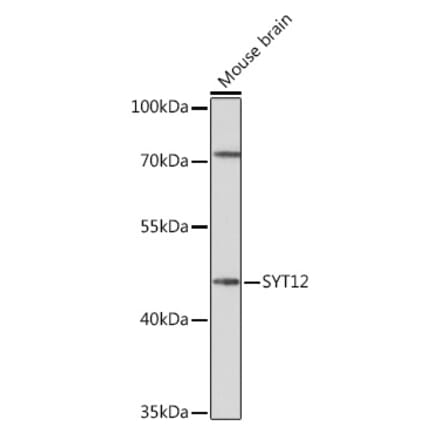 Western Blot - Anti-SYT12 Antibody (A93332) - Antibodies.com