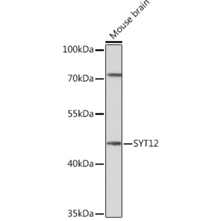 Western Blot - Anti-SYT12 Antibody (A93332) - Antibodies.com